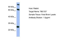 TBC1D7 Rabbit anti-Human, Polyclonal, Novus Biologicals 0.1ml; Unconjugated:Antibodies,